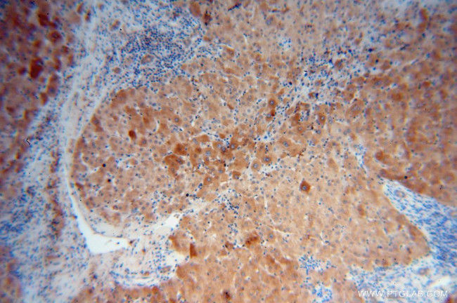 Adenylosuccinate lyase Antibody in Immunohistochemistry (Paraffin) (IHC (P))