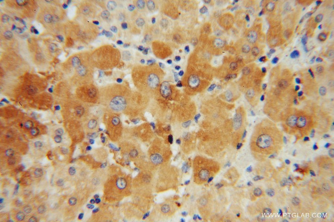 Adenylosuccinate lyase Antibody in Immunohistochemistry (Paraffin) (IHC (P))