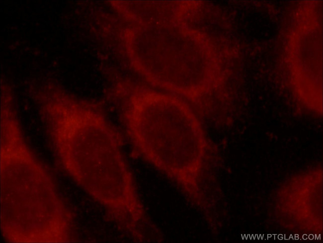 MLYCD Antibody in Immunocytochemistry (ICC/IF)