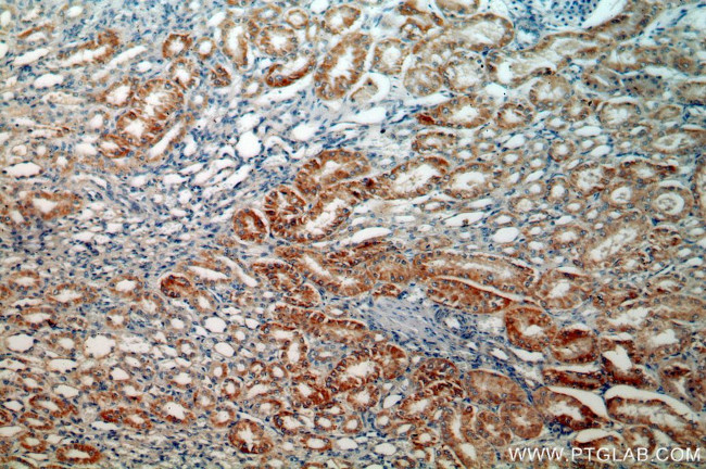 MLYCD Antibody in Immunohistochemistry (Paraffin) (IHC (P))