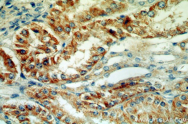 MLYCD Antibody in Immunohistochemistry (Paraffin) (IHC (P))