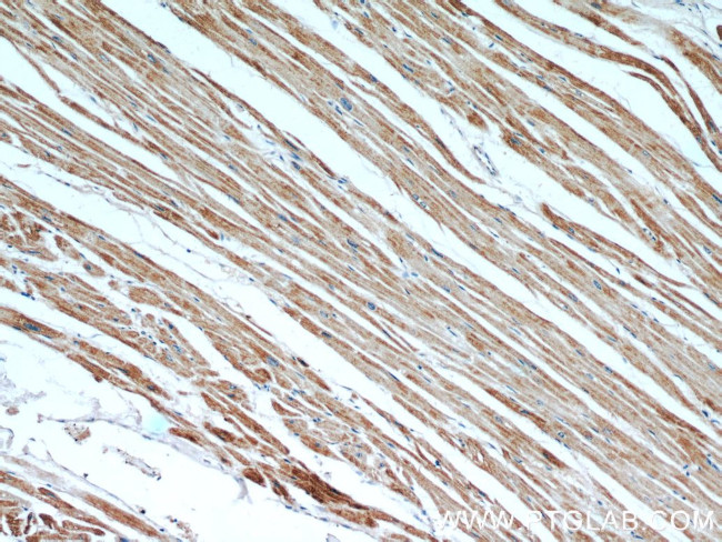 MLYCD Antibody in Immunohistochemistry (Paraffin) (IHC (P))