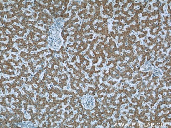 MLYCD Antibody in Immunohistochemistry (Paraffin) (IHC (P))