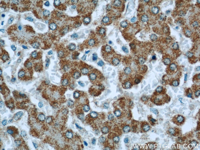 MLYCD Antibody in Immunohistochemistry (Paraffin) (IHC (P))