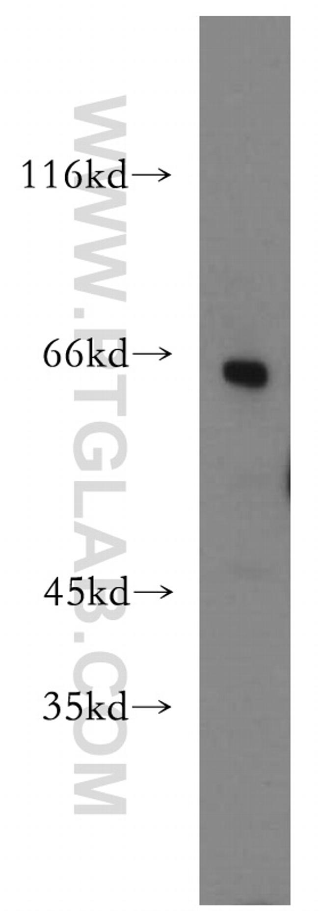 MLYCD Antibody in Western Blot (WB)