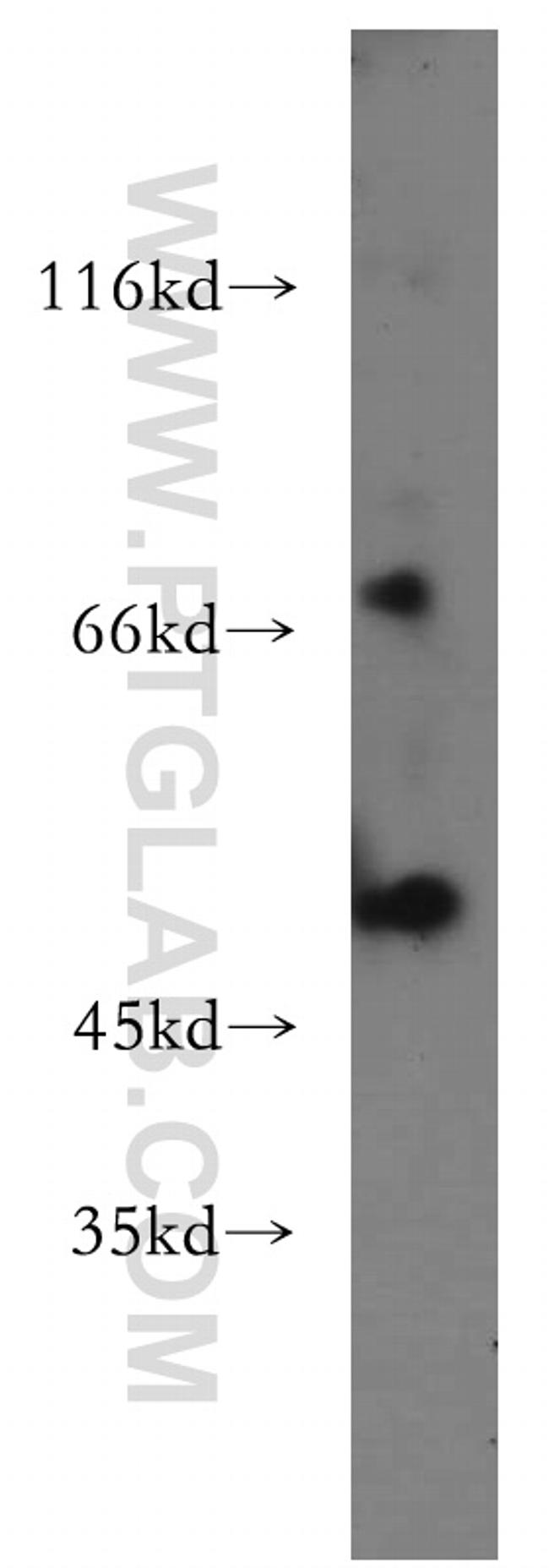 MLYCD Antibody in Western Blot (WB)