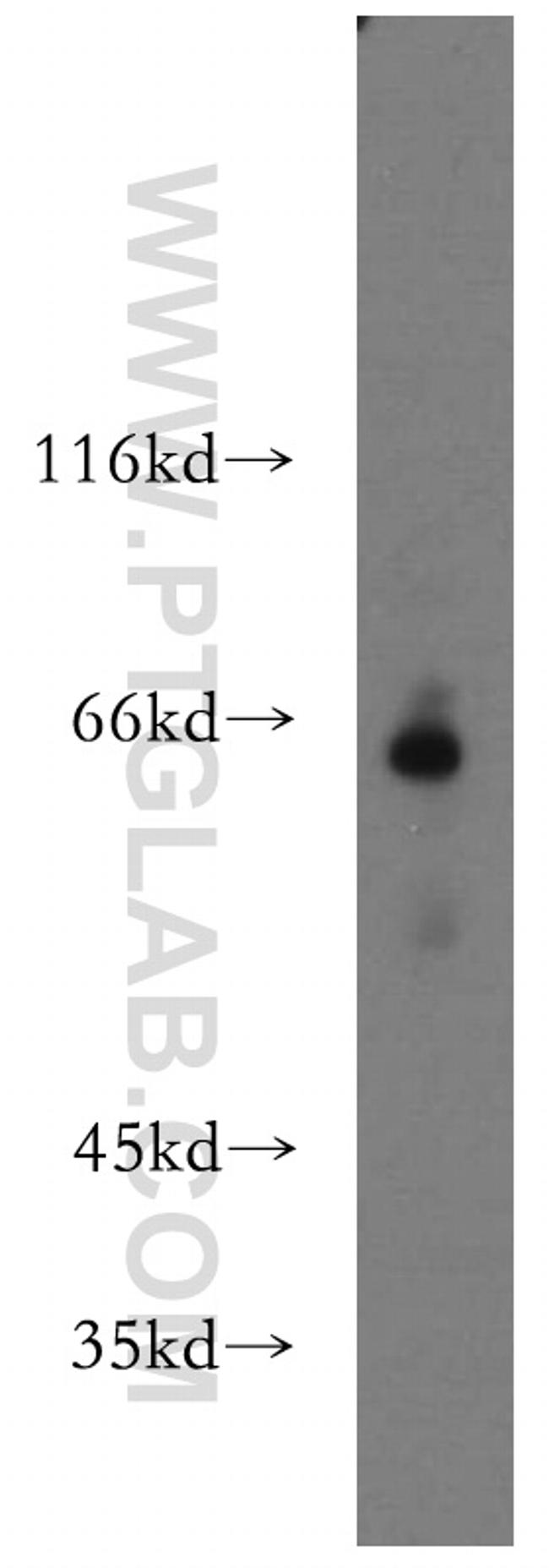 MLYCD Antibody in Western Blot (WB)