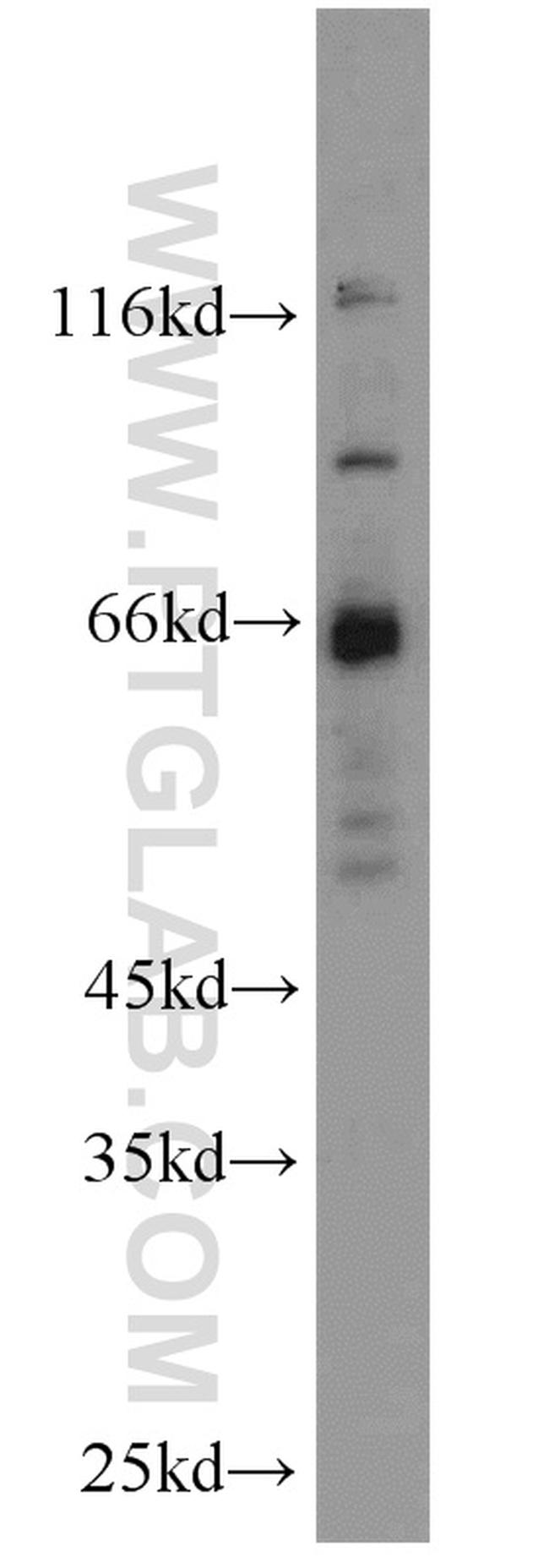 MLYCD Antibody in Western Blot (WB)