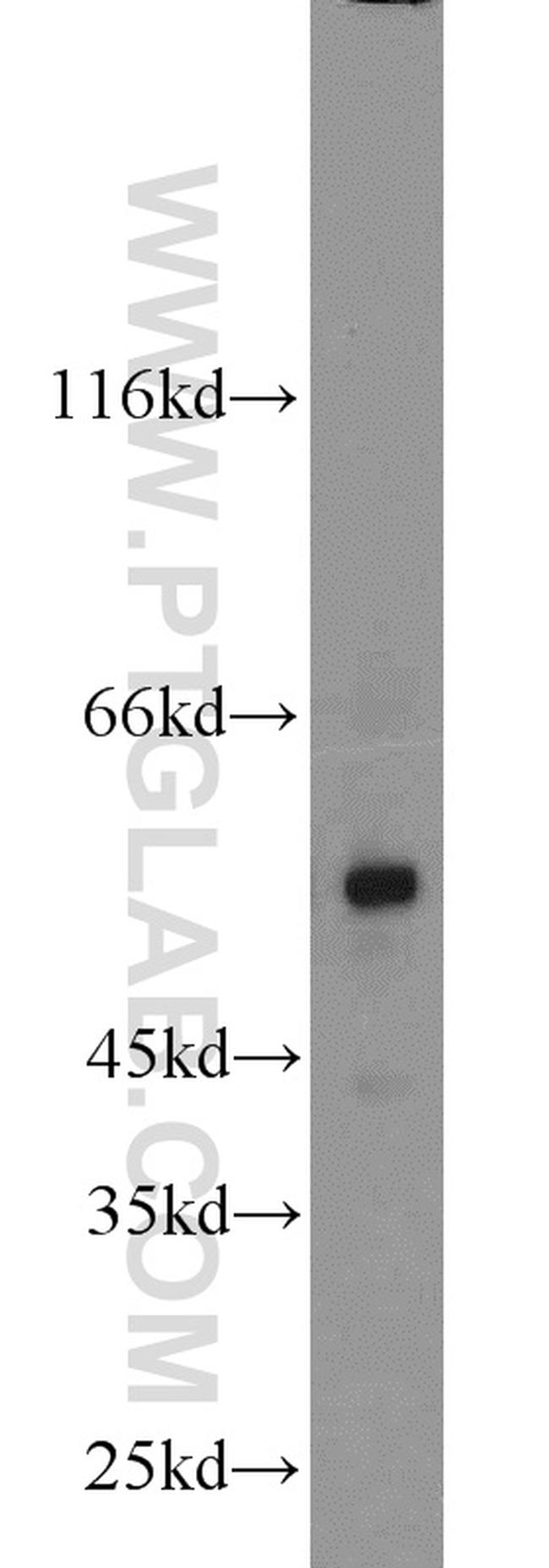 MLYCD Antibody in Western Blot (WB)