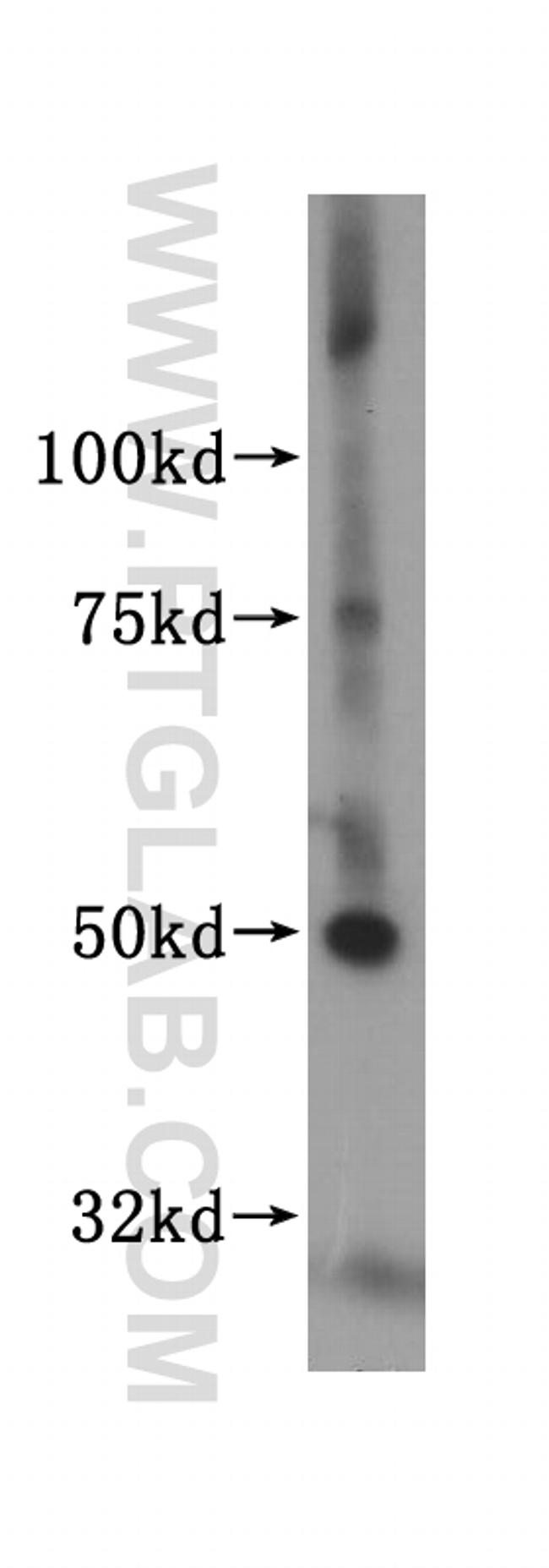 MLYCD Antibody in Western Blot (WB)