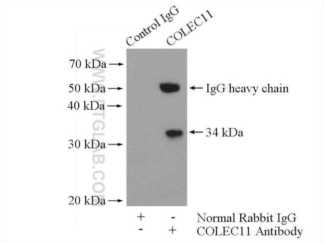 COLEC11 Antibody in Immunoprecipitation (IP)