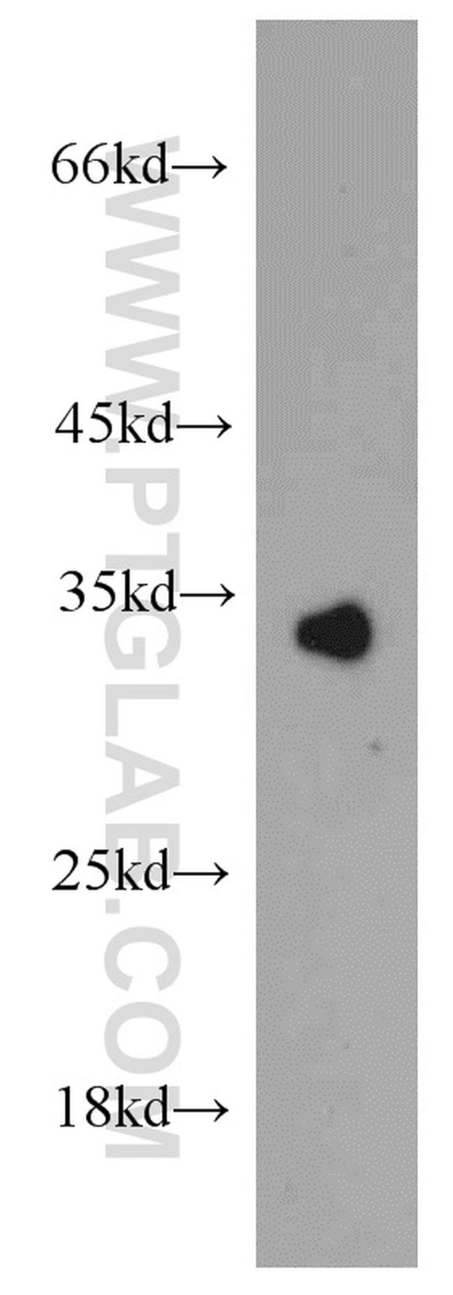 COLEC11 Antibody in Western Blot (WB)
