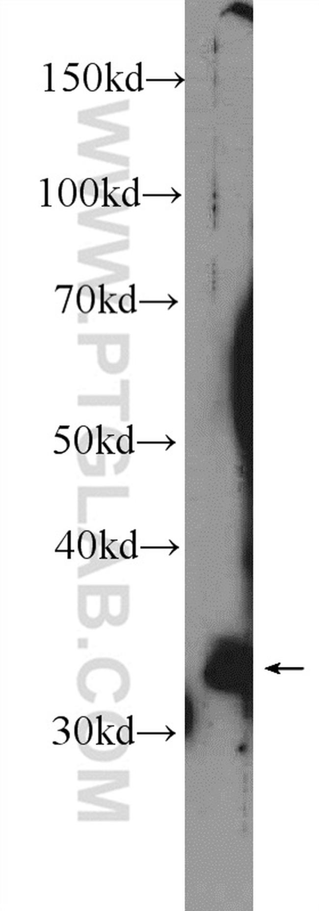 COLEC11 Antibody in Western Blot (WB)