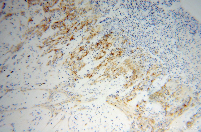 SPARC Antibody in Immunohistochemistry (Paraffin) (IHC (P))