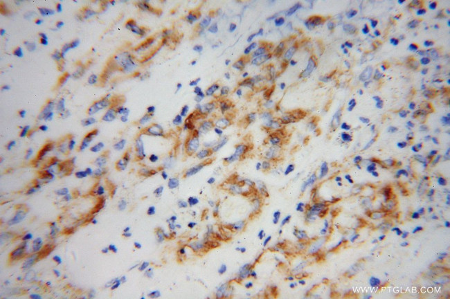 SPARC Antibody in Immunohistochemistry (Paraffin) (IHC (P))