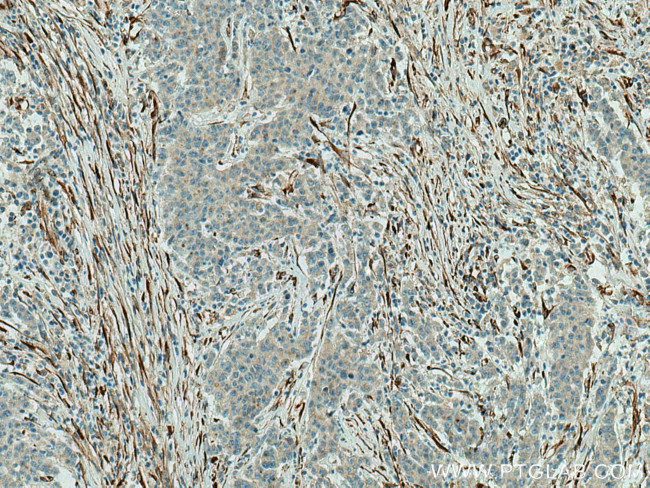 SPARC Antibody in Immunohistochemistry (Paraffin) (IHC (P))