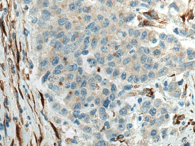 SPARC Antibody in Immunohistochemistry (Paraffin) (IHC (P))