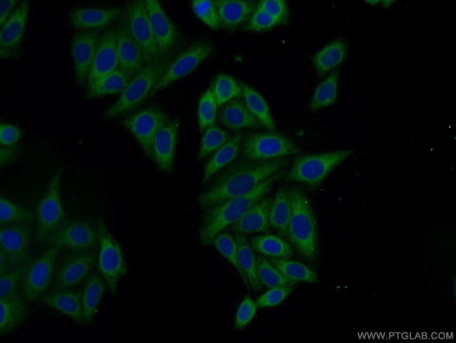 VAPA Antibody in Immunocytochemistry (ICC/IF)