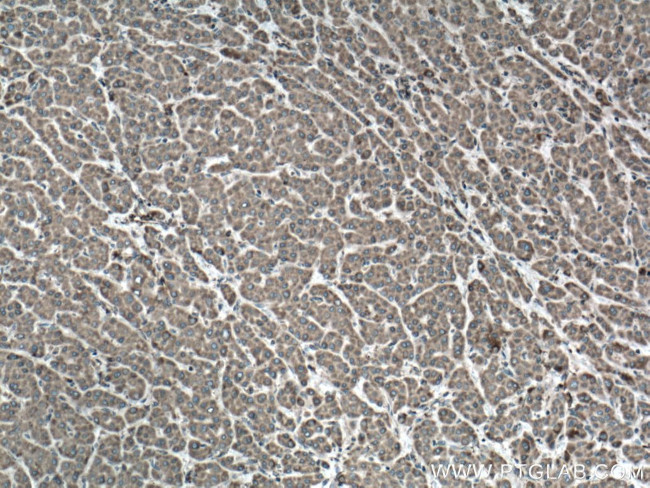 VAPA Antibody in Immunohistochemistry (Paraffin) (IHC (P))