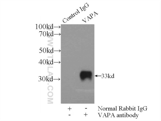 VAPA Antibody in Immunoprecipitation (IP)