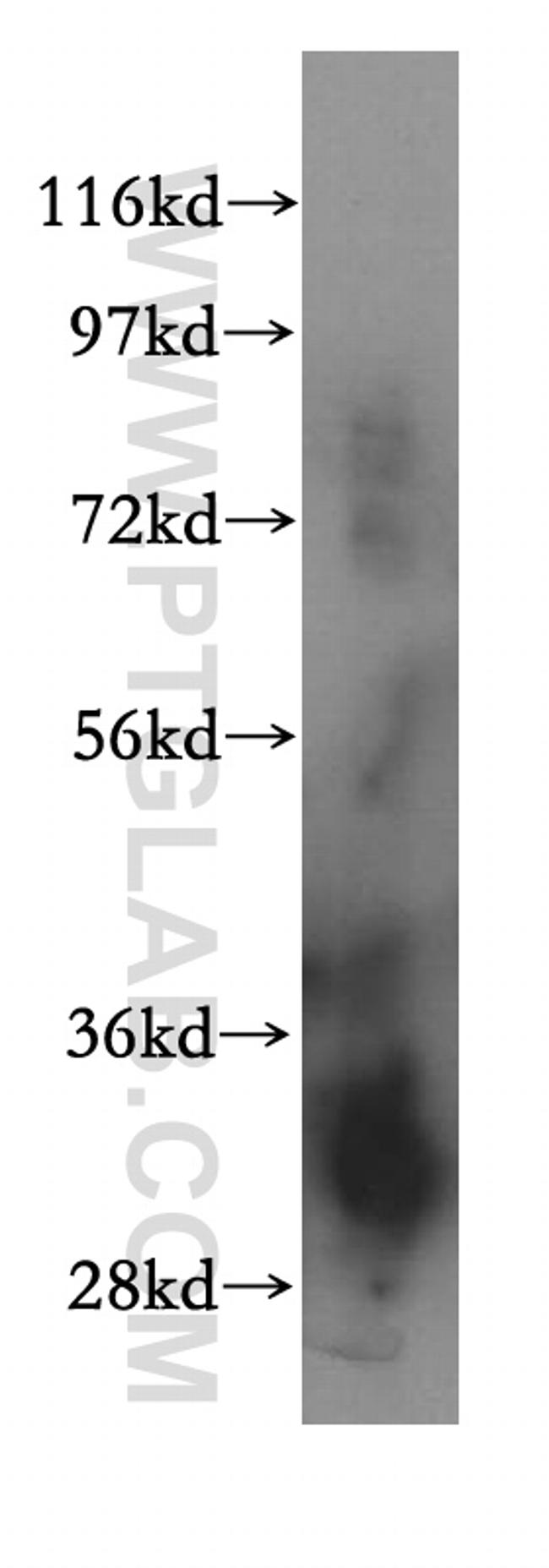 VAPA Antibody in Western Blot (WB)