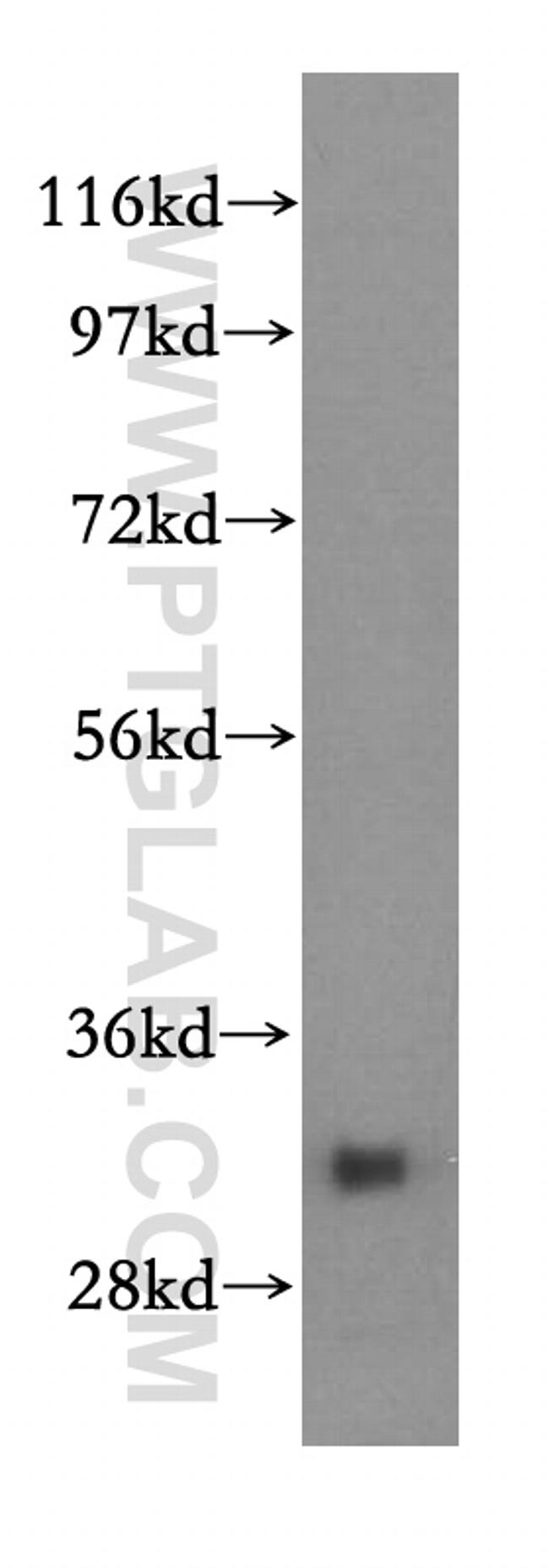 VAPA Antibody in Western Blot (WB)