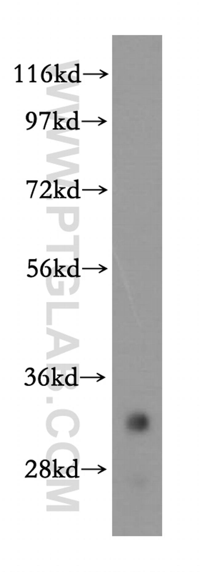 VAPA Antibody in Western Blot (WB)