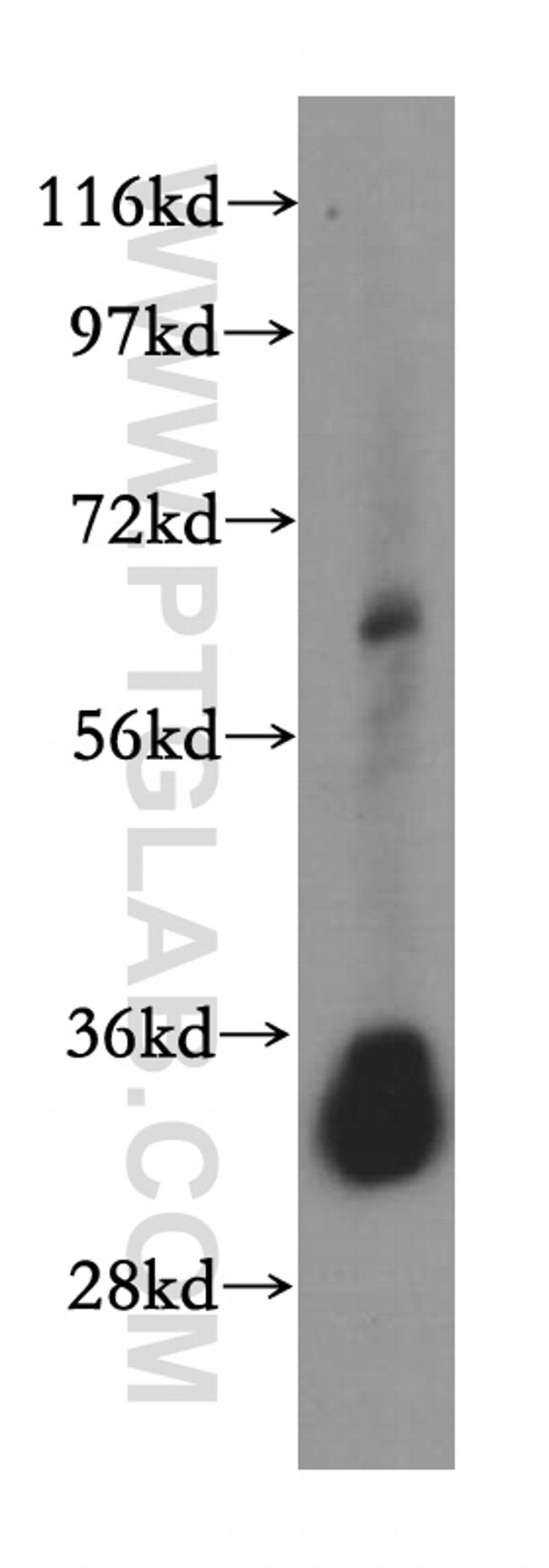 VAPA Antibody in Western Blot (WB)