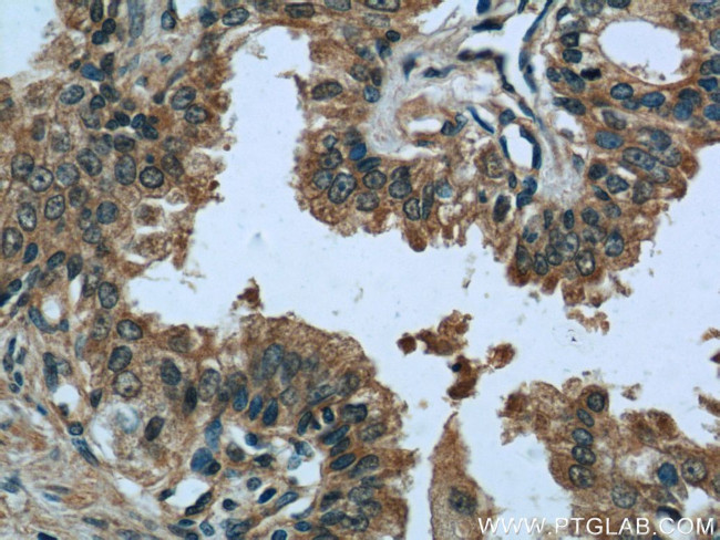 EIF1 Antibody in Immunohistochemistry (Paraffin) (IHC (P))