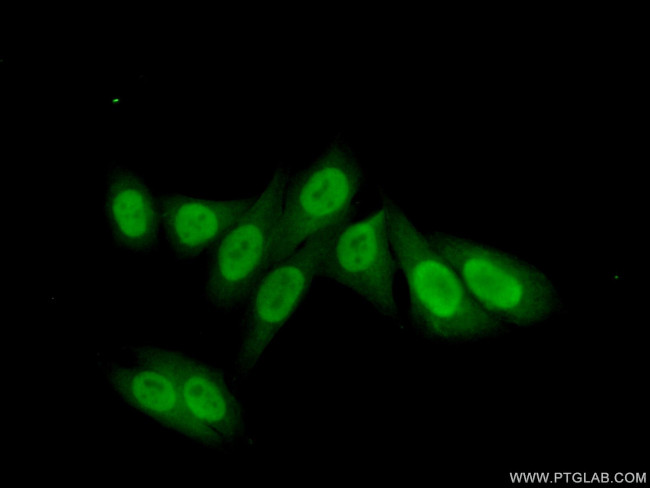 POLE3 Antibody in Immunocytochemistry (ICC/IF)