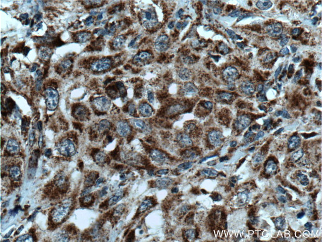 DHRS4 Antibody in Immunohistochemistry (Paraffin) (IHC (P))