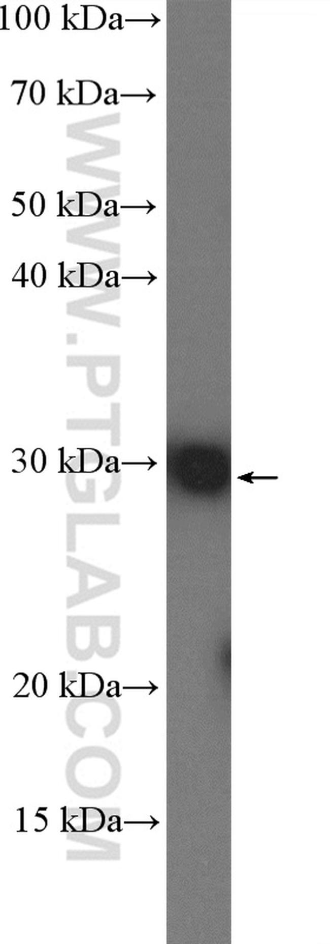 DHRS4 Antibody in Western Blot (WB)