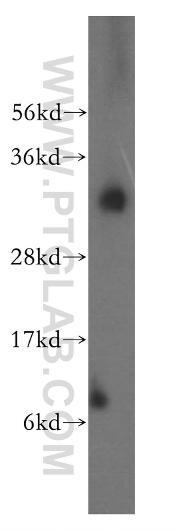 ATP6V1E1 Antibody in Western Blot (WB)