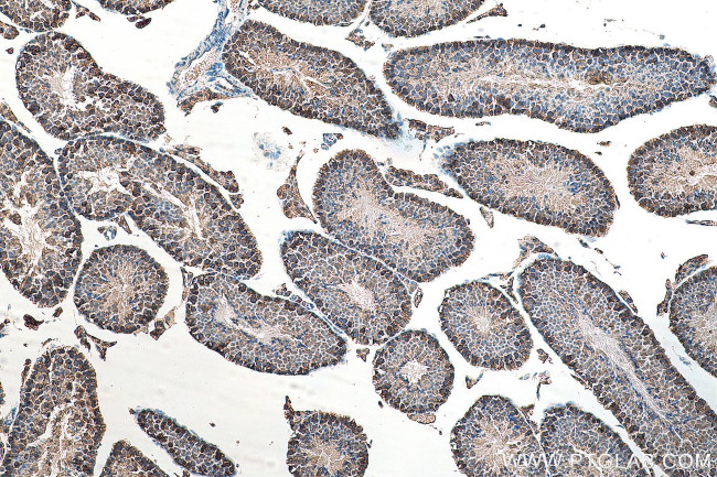 ATP6V1E1 Antibody in Immunohistochemistry (Paraffin) (IHC (P))