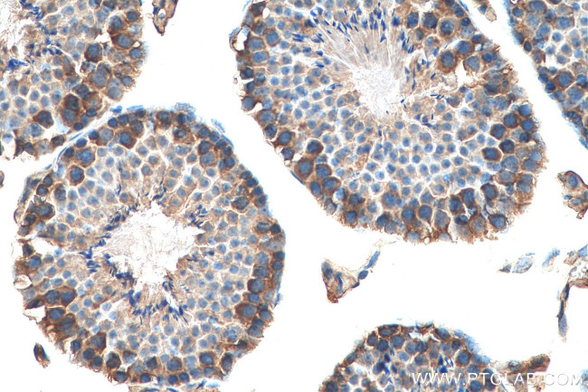 ATP6V1E1 Antibody in Immunohistochemistry (Paraffin) (IHC (P))