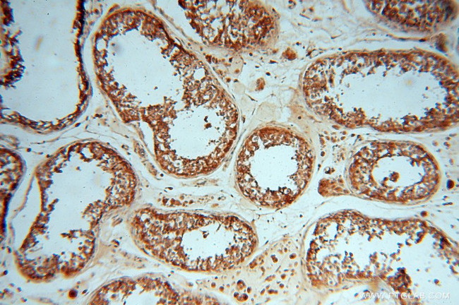 ATP6V1E1 Antibody in Immunohistochemistry (Paraffin) (IHC (P))