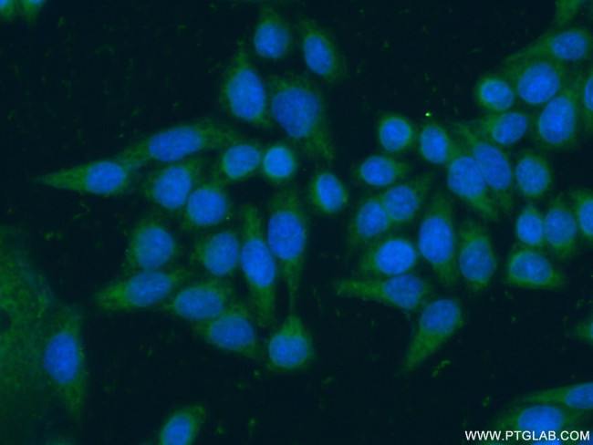 ARF5 Antibody in Immunocytochemistry (ICC/IF)