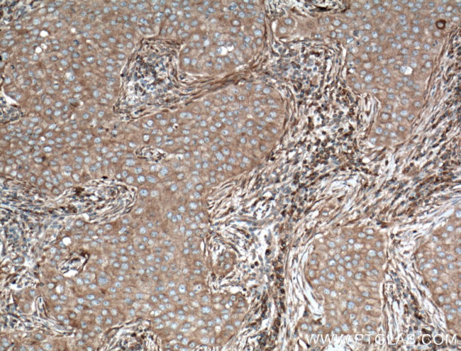 ARF5 Antibody in Immunohistochemistry (Paraffin) (IHC (P))