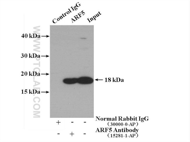 ARF5 Antibody in Immunoprecipitation (IP)