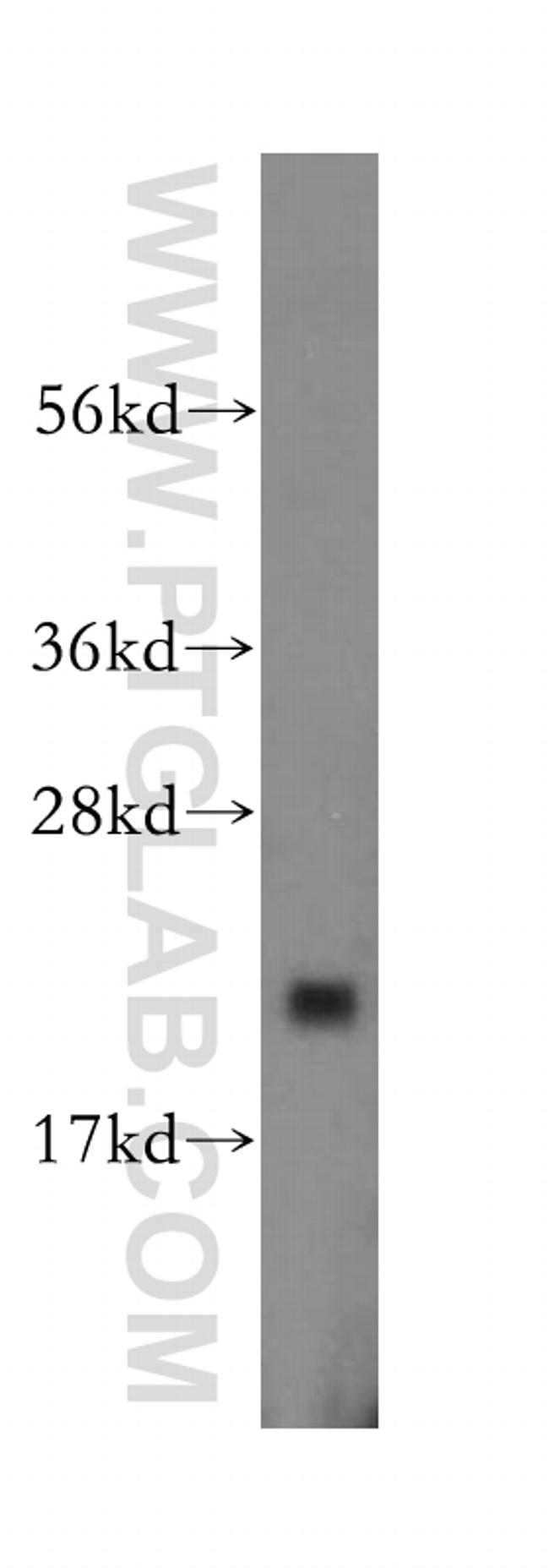 ARF5 Antibody in Western Blot (WB)