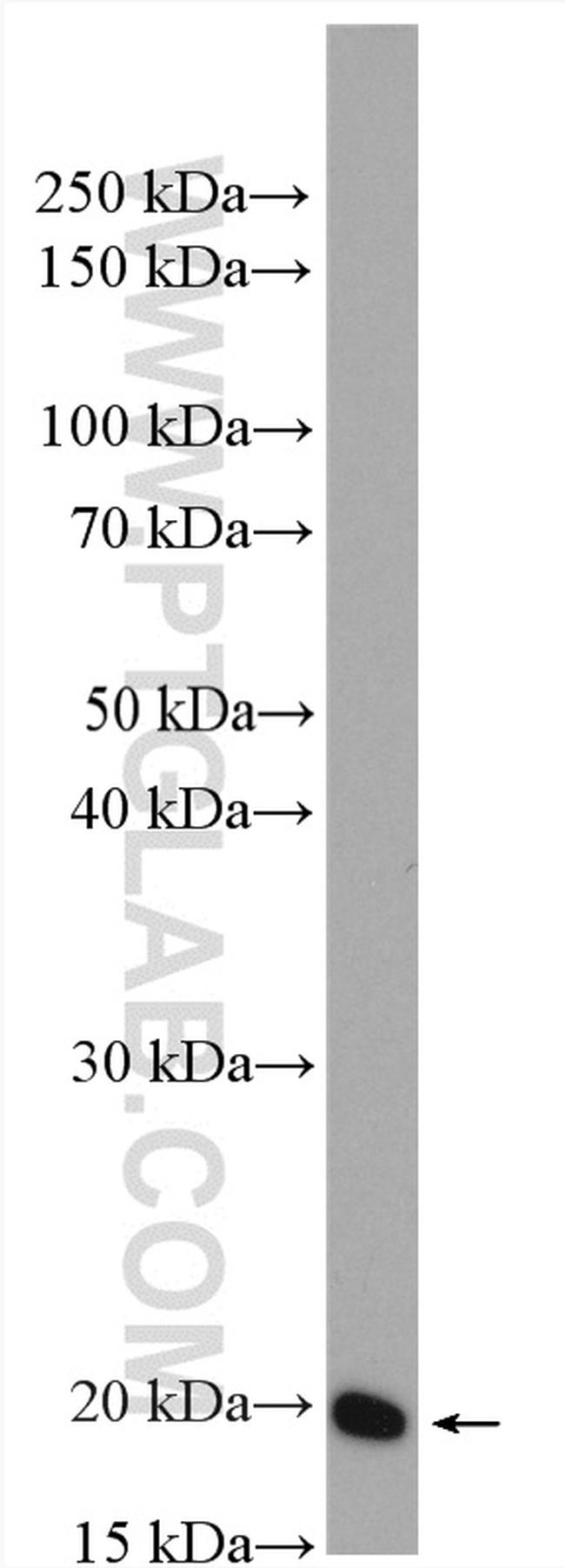 ARF5 Antibody in Western Blot (WB)