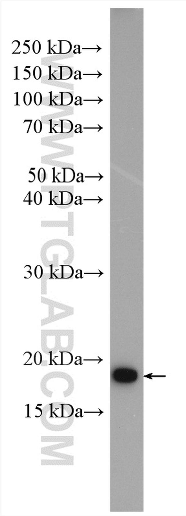 ARF5 Antibody in Western Blot (WB)