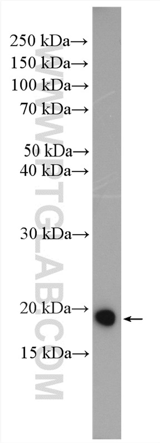 ARF5 Antibody in Western Blot (WB)