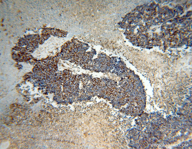 HSP60 Antibody in Immunohistochemistry (Paraffin) (IHC (P))