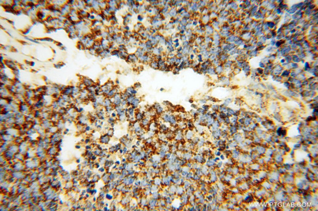 HSP60 Antibody in Immunohistochemistry (Paraffin) (IHC (P))