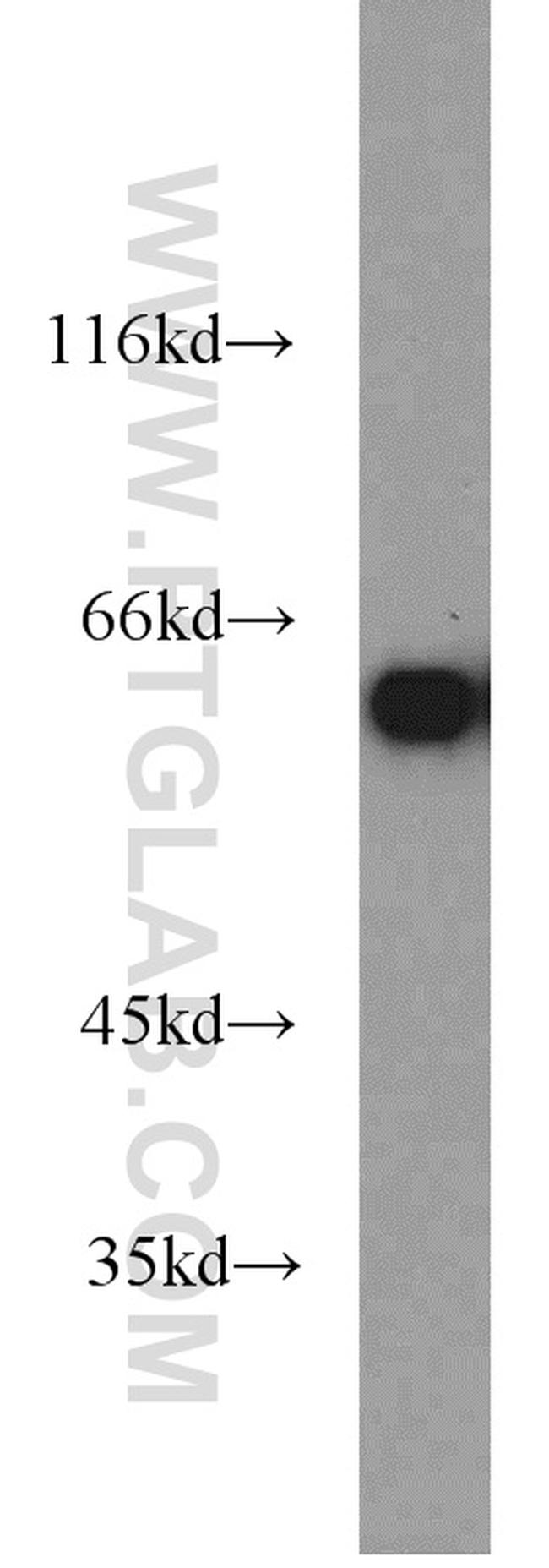 HSP60 Antibody in Western Blot (WB)