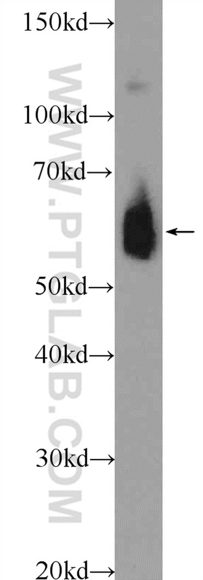 HSP60 Antibody in Western Blot (WB)