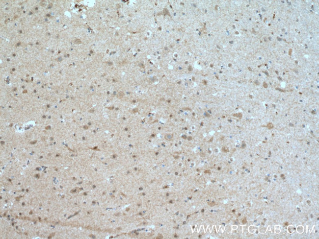 HJURP Antibody in Immunohistochemistry (Paraffin) (IHC (P))