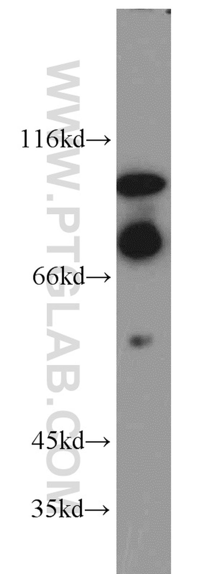 HJURP Antibody in Western Blot (WB)