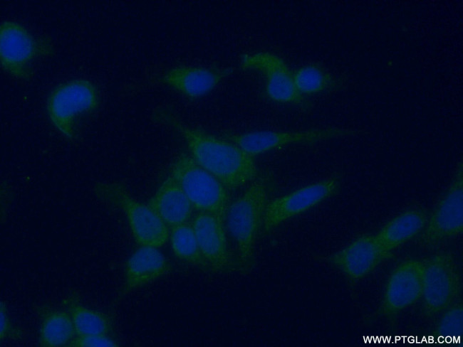 GALK1 Antibody in Immunocytochemistry (ICC/IF)